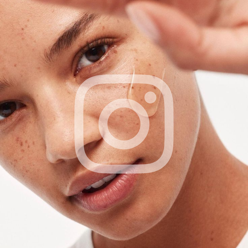 INSTAGRAM thumbnail