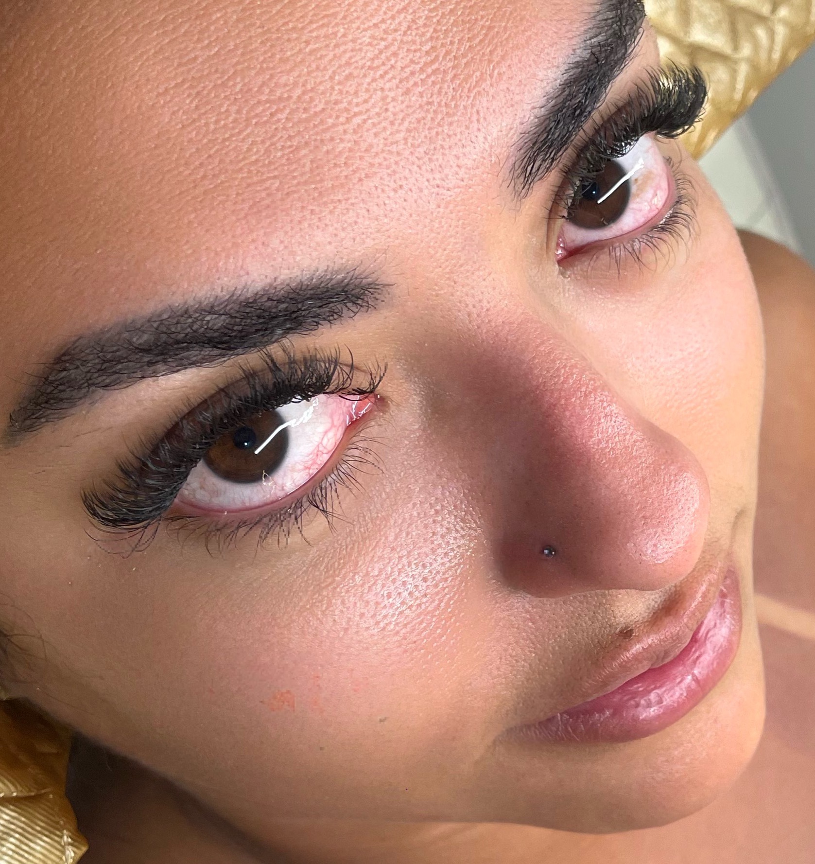 Cuidado pós ✨ thumbnail