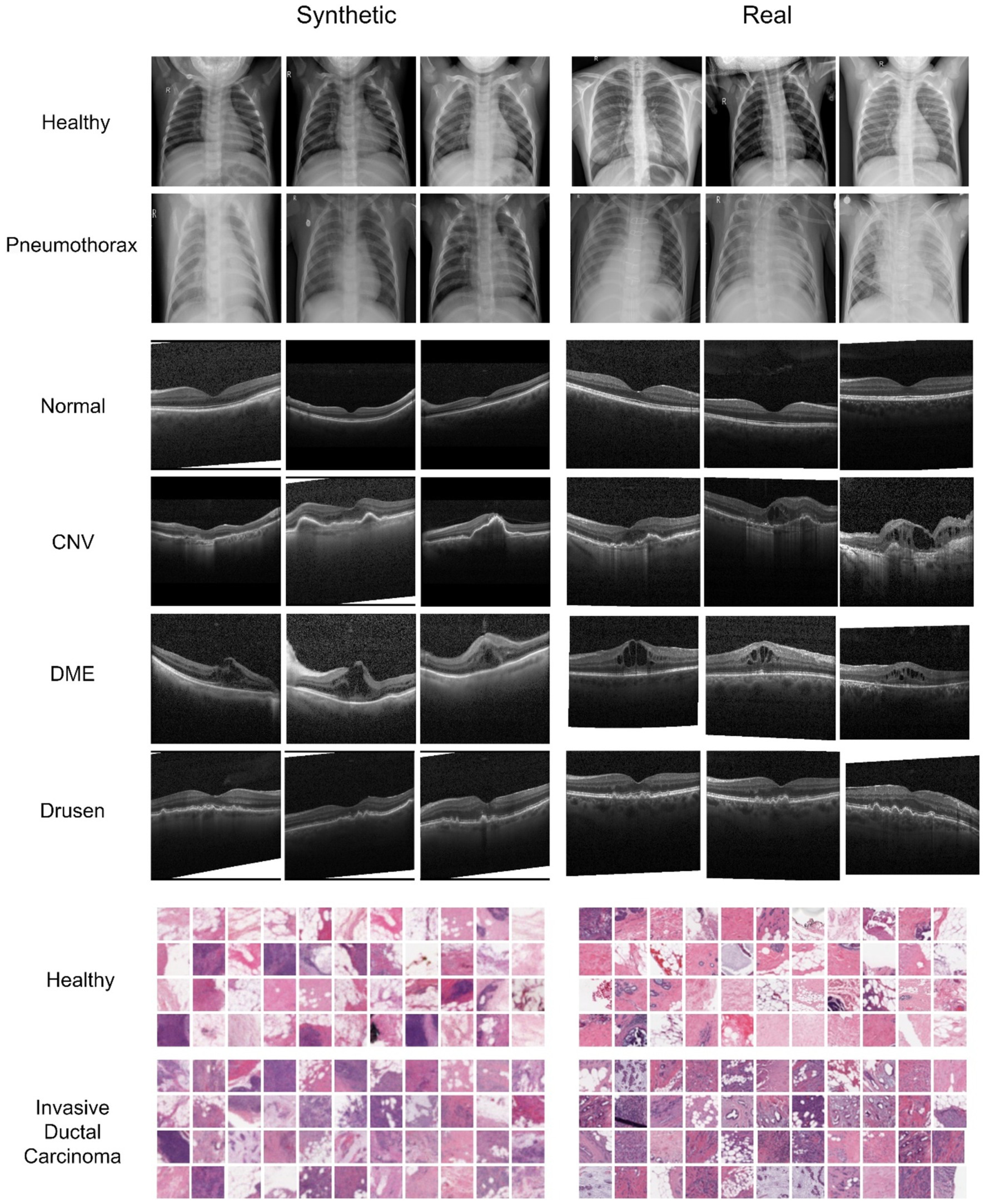 Is synthetic data generation effective in maintaining clinical biomarkers? Investigating diffusion models across diverse imaging modalities thumbnail
