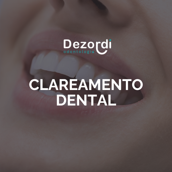 Clareamento dental thumbnail