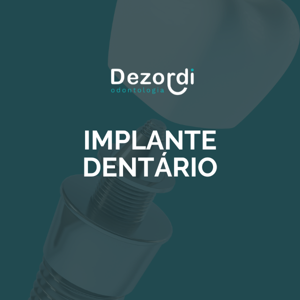 Implante dentário thumbnail