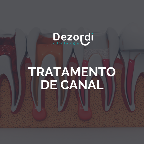 Tratamento de canal thumbnail