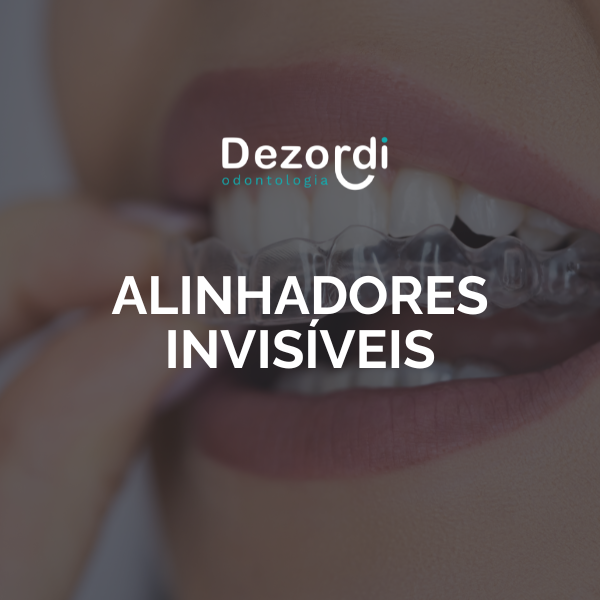 Alinhadores thumbnail