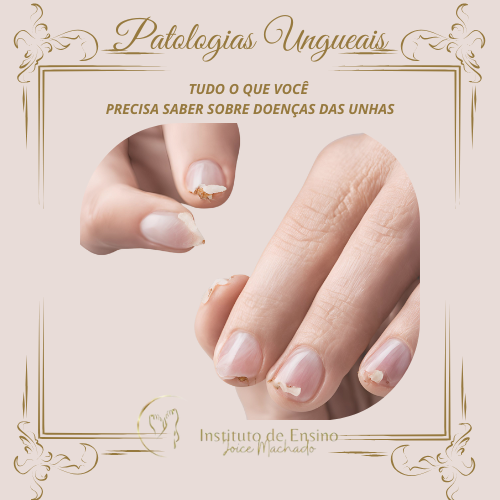 E-Book Patologias ungueais/ Tudo o que você precisa saber sobre doenças das unhas thumbnail
