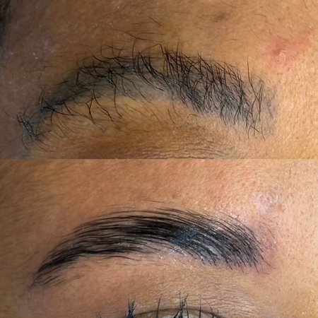 Reconstrução  thumbnail