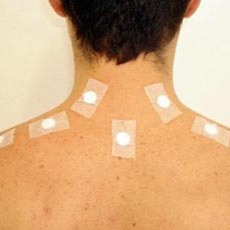 Stiperterapia  thumbnail