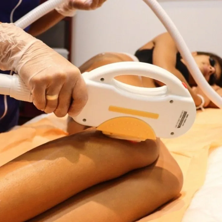 DEPILACIÓN LÁSER thumbnail