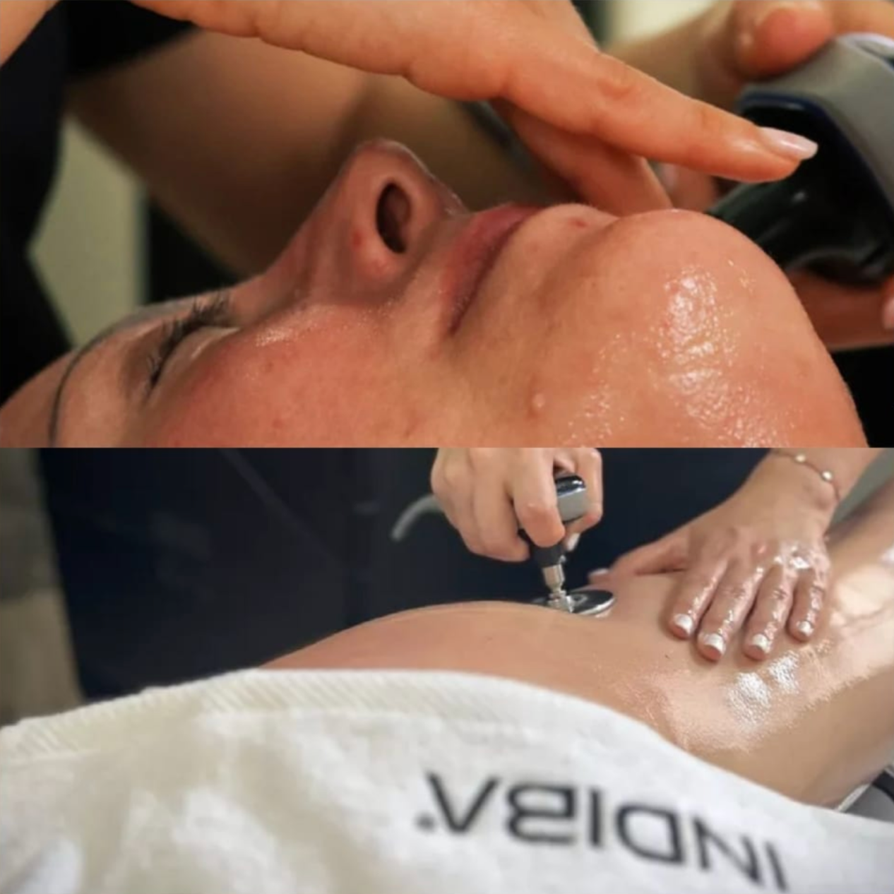 INDIBA FACIAL - CORPORAL thumbnail