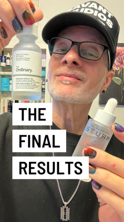 HOW DO THE ORDINARY’S $10 HA SERUM AND BARBARA STURM’S $325 HA SERUM COMPARE?  thumbnail