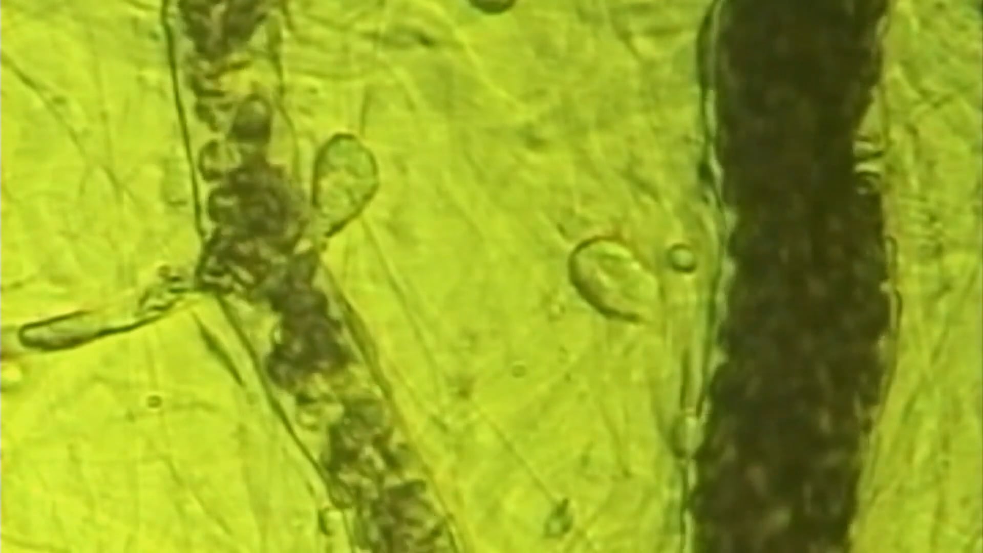 BEMER Local Circulation Effects thumbnail