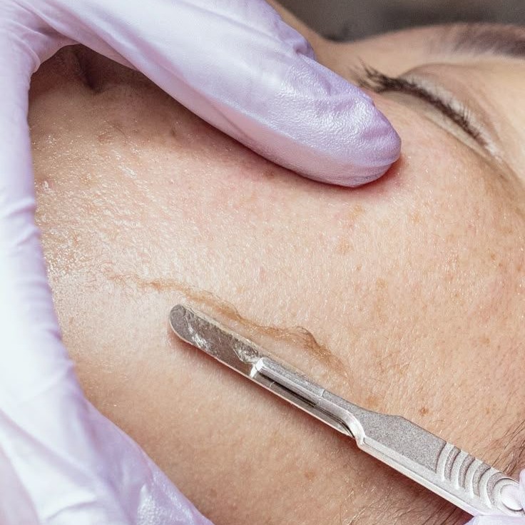 Dermaplaning thumbnail