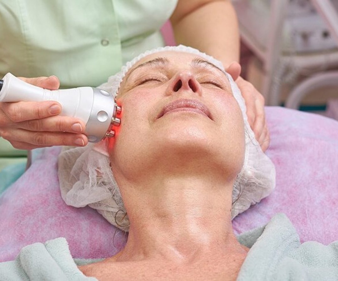 Radiofrequência - R$50,00 Região thumbnail