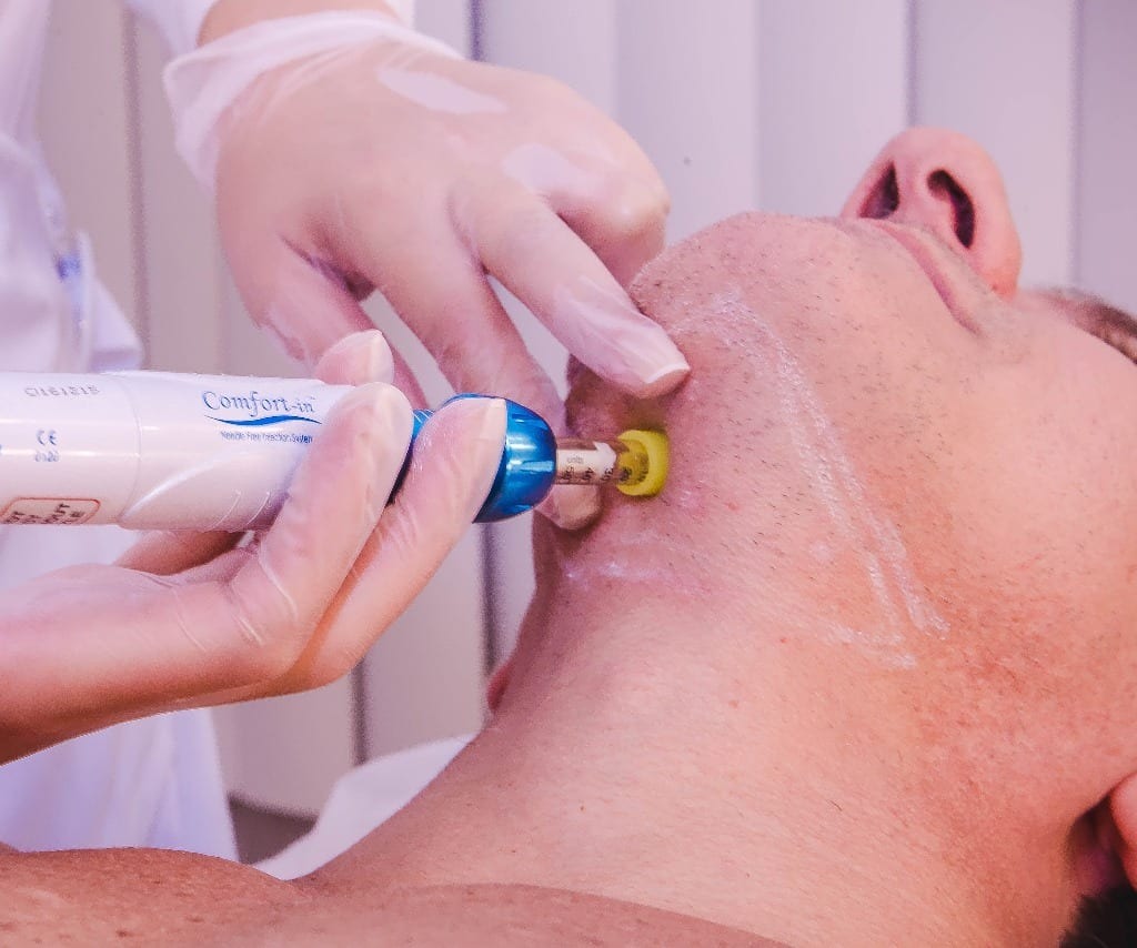 Enzima papada - R$180,00 thumbnail