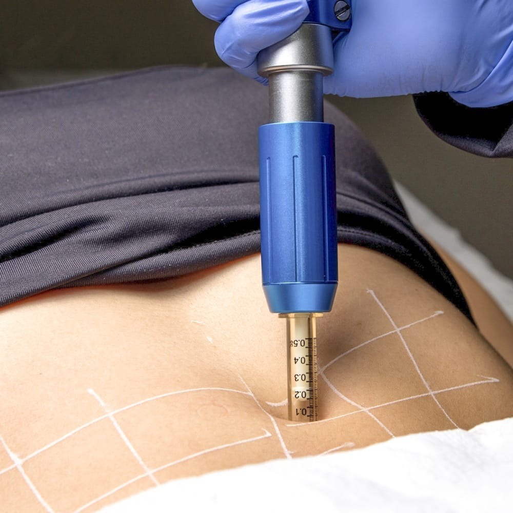 Enzima - R$180,00 por região thumbnail