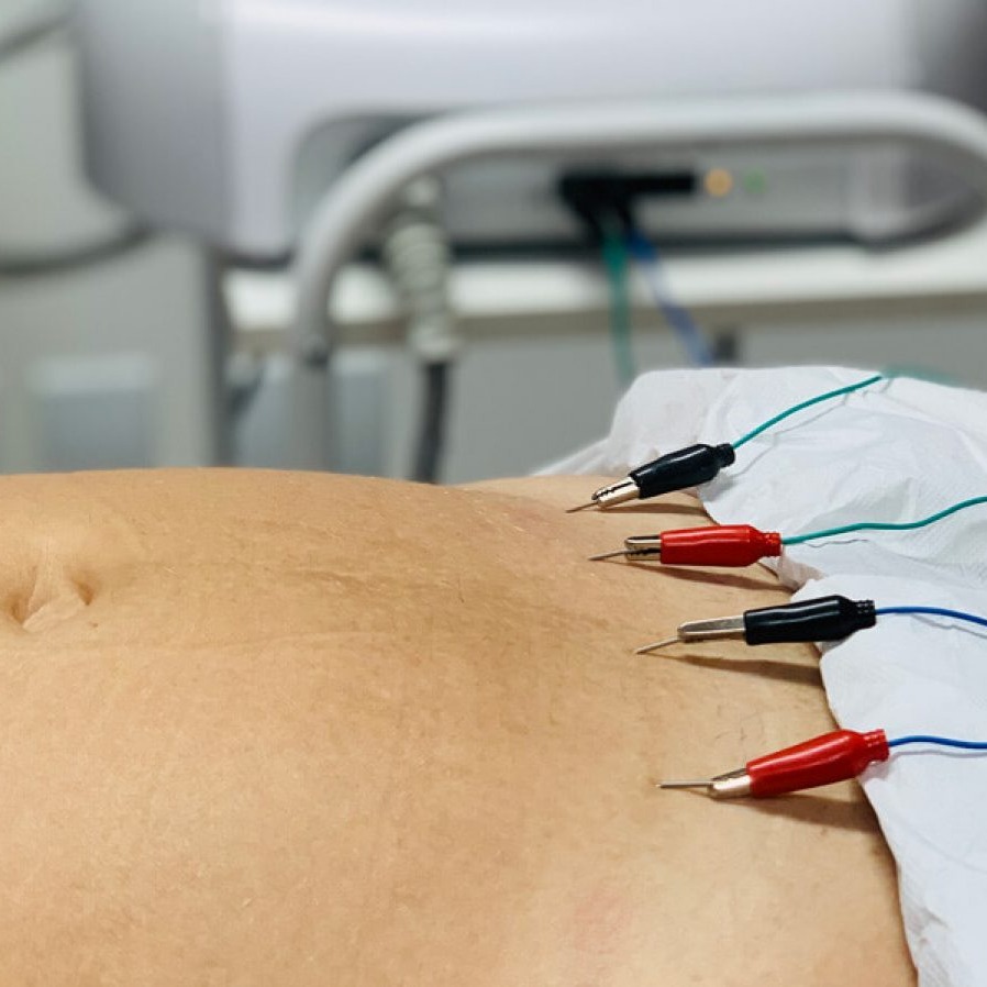 Eletrolipolise - R$75,00 thumbnail