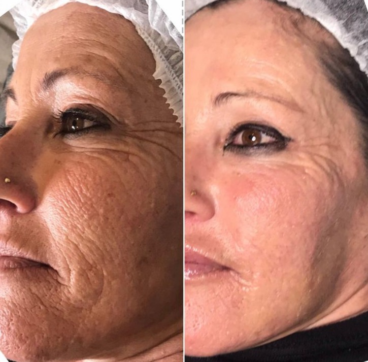 Skinbooster thumbnail