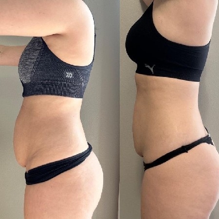 MASSAGEM MODELADORA 💆🏻‍♀️ thumbnail