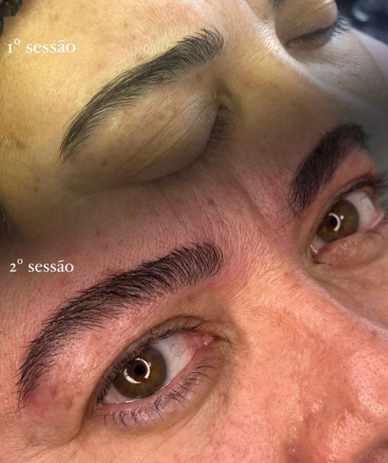 Reconstrução dos Fios thumbnail