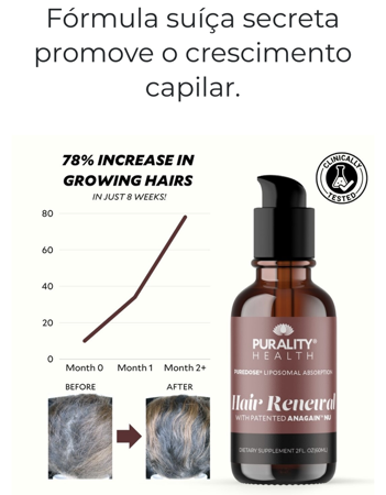 REGROW DEAD HAIR-COMPRA AQUI thumbnail