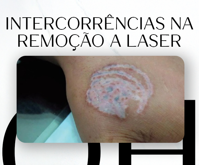 Intercorrências thumbnail