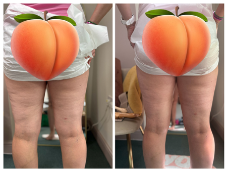 ZOOM HANDS ON CELLULITE TRAINING by @Desaunique | Stan thumbnail