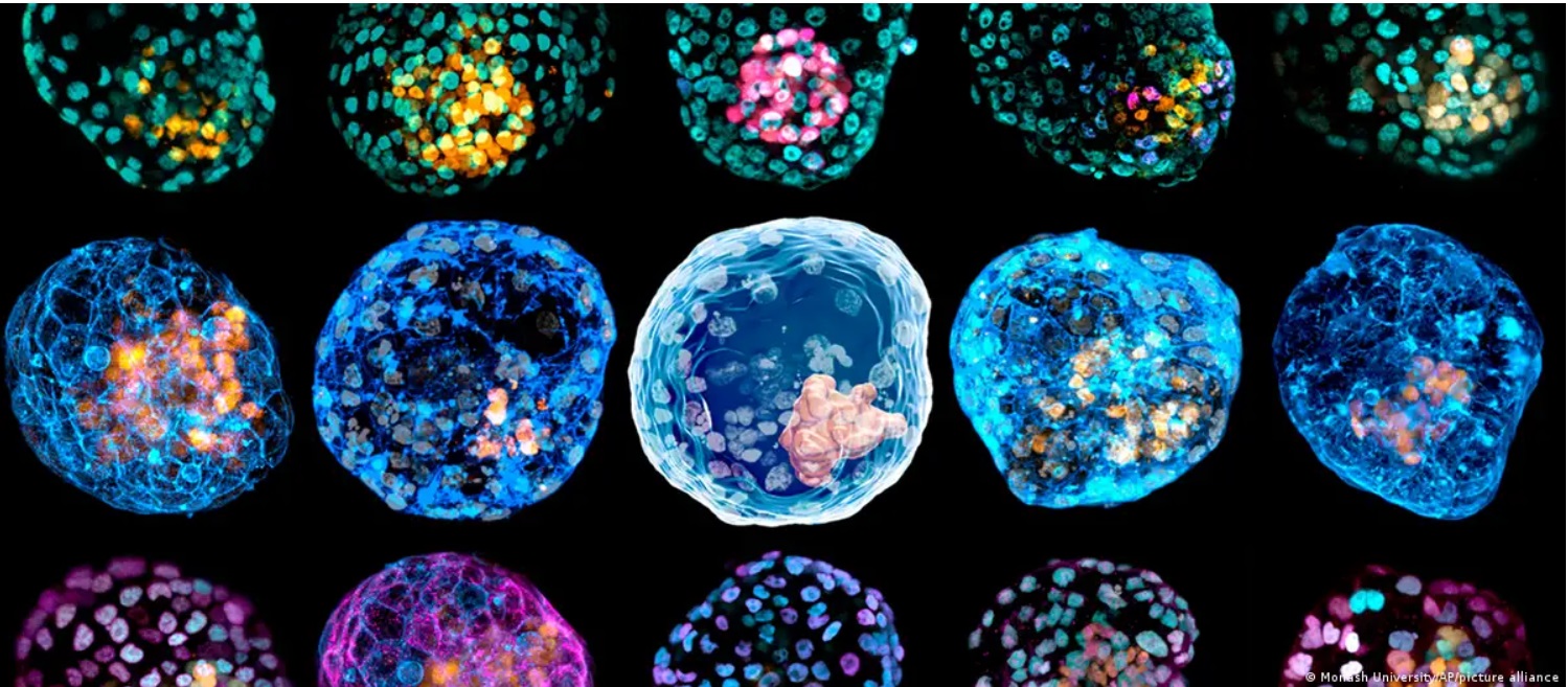 Embryos aus dem Labor - ohne Sperma und Eizelle (DW Text) thumbnail