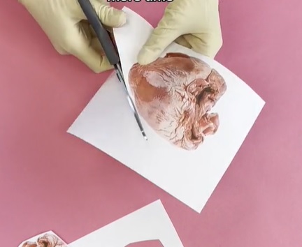 You might live longer if your surgeon is female (DW TikTok) thumbnail