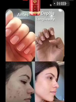 Você não vai acreditar 😯 Long beauty além de ser um ótimo suplemento para o cuidado com o cabelo, ele também cuida da su