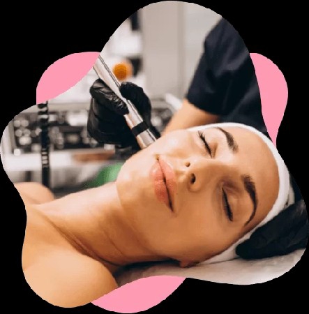 Curso Peeling Diamante  thumbnail