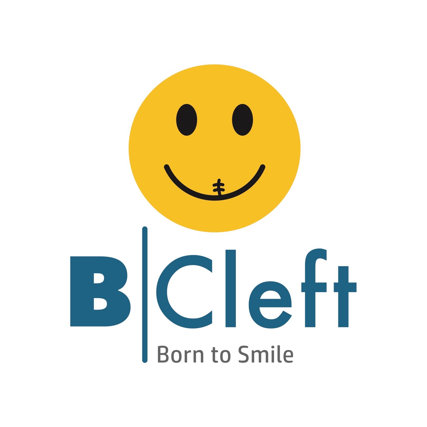 Brazilian Cleft - Fissura Labiopalatina thumbnail