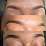Brow Removal thumbnail