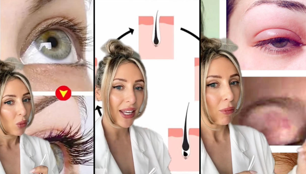 Viral eyelash growth serum video sparks warnings over side-effects thumbnail