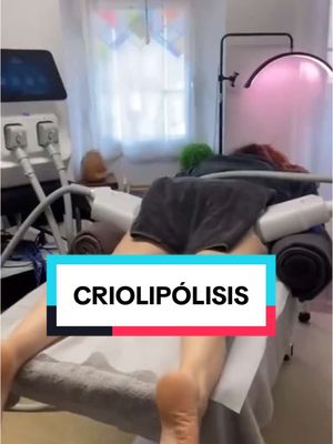 #criolipolisis #castellardelvalles #calmetge #loliterapia 