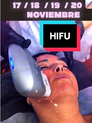 Próximas sesiones del tratamiento Reafirmante #hifu #tratamientoestetico #loliterapia #castellardelvalles 