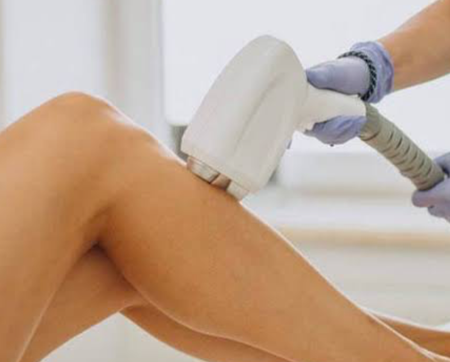 Depilação a Laser thumbnail