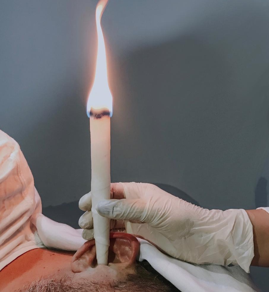 Cone Chinês thumbnail