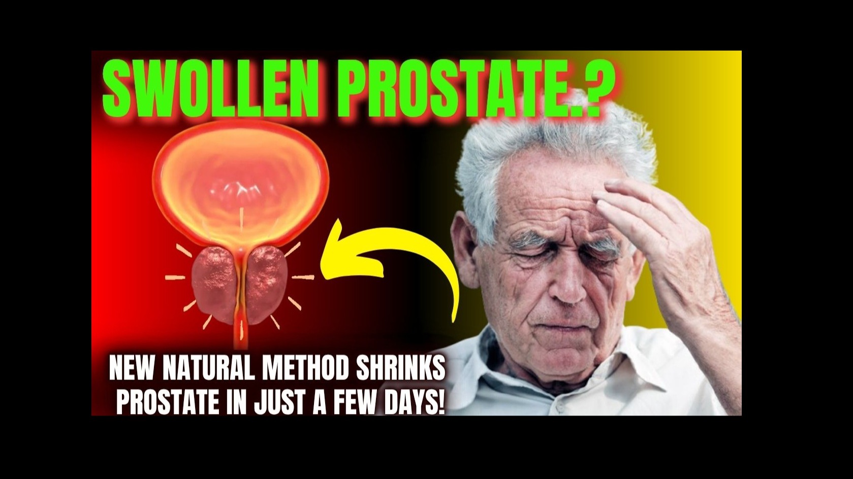 BioSite banner for @prostate