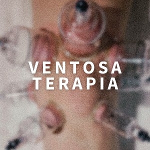 Ventosaterapia  thumbnail