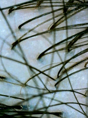 Cuero Cabelludo ✨ Healthy Scalp thumbnail