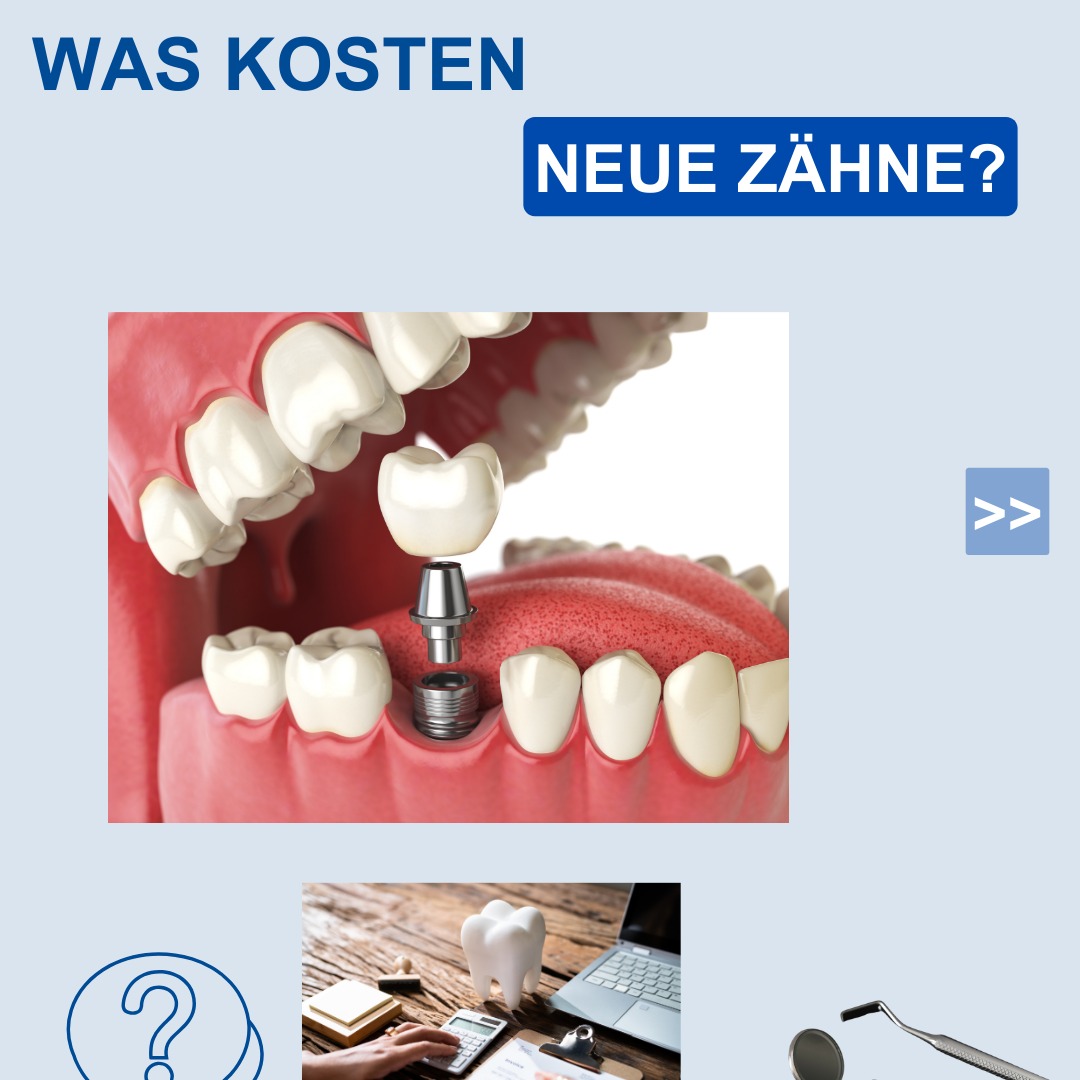 Alle Infos zu Zahn Sorglos -hier!📌 thumbnail