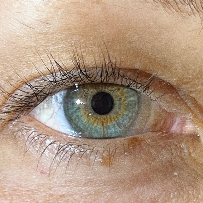 BOOK AN IRIDOLOGY ANALYSIS thumbnail
