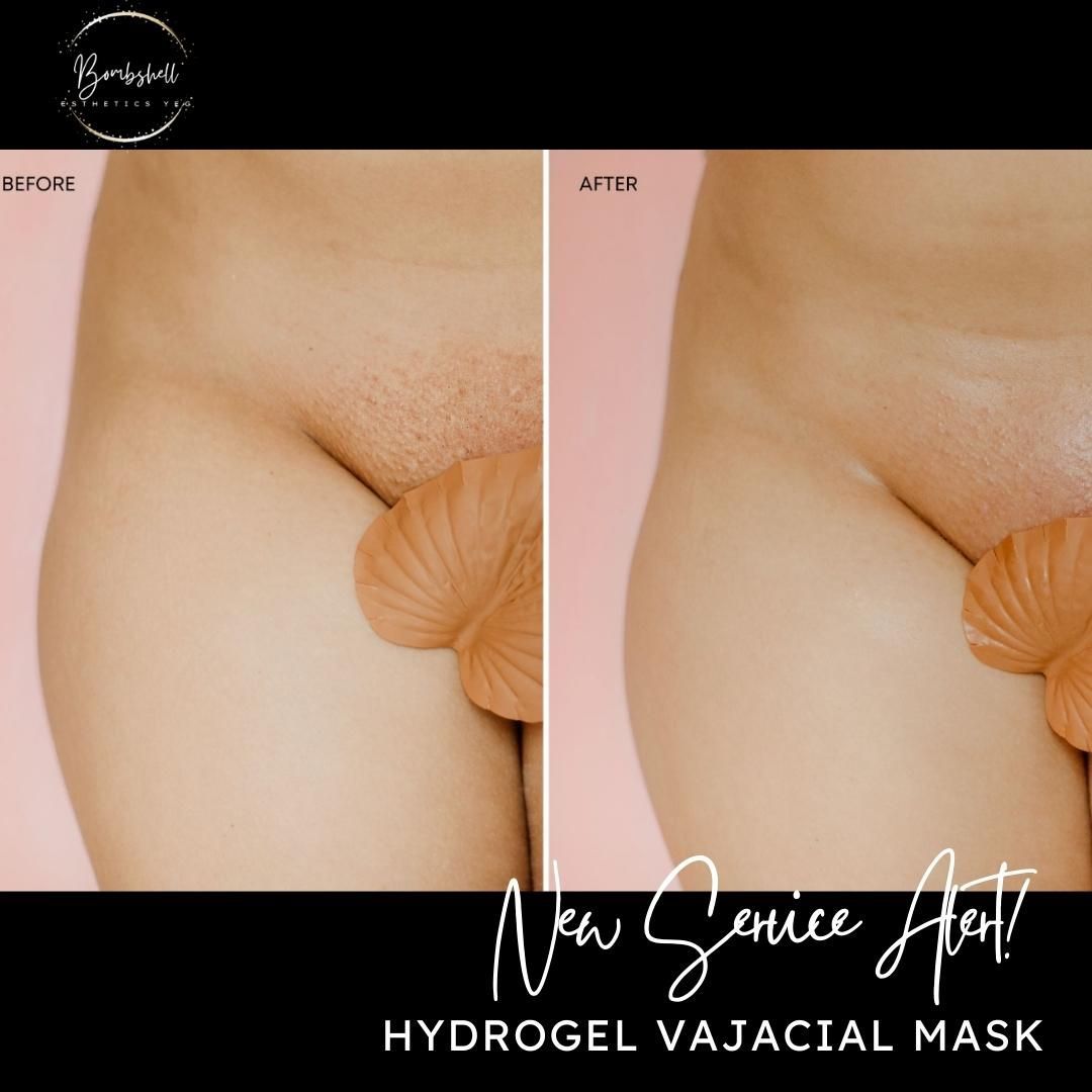 NEW SERVICE ALERT! 
Finsh your Brazilian off with a hydrogel vajacial mask that cools, calms and hydrates the skin after