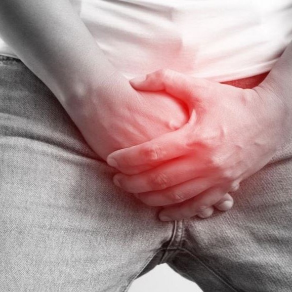 Varicocele Treatments in Pakistan - Embolization or Surgery thumbnail