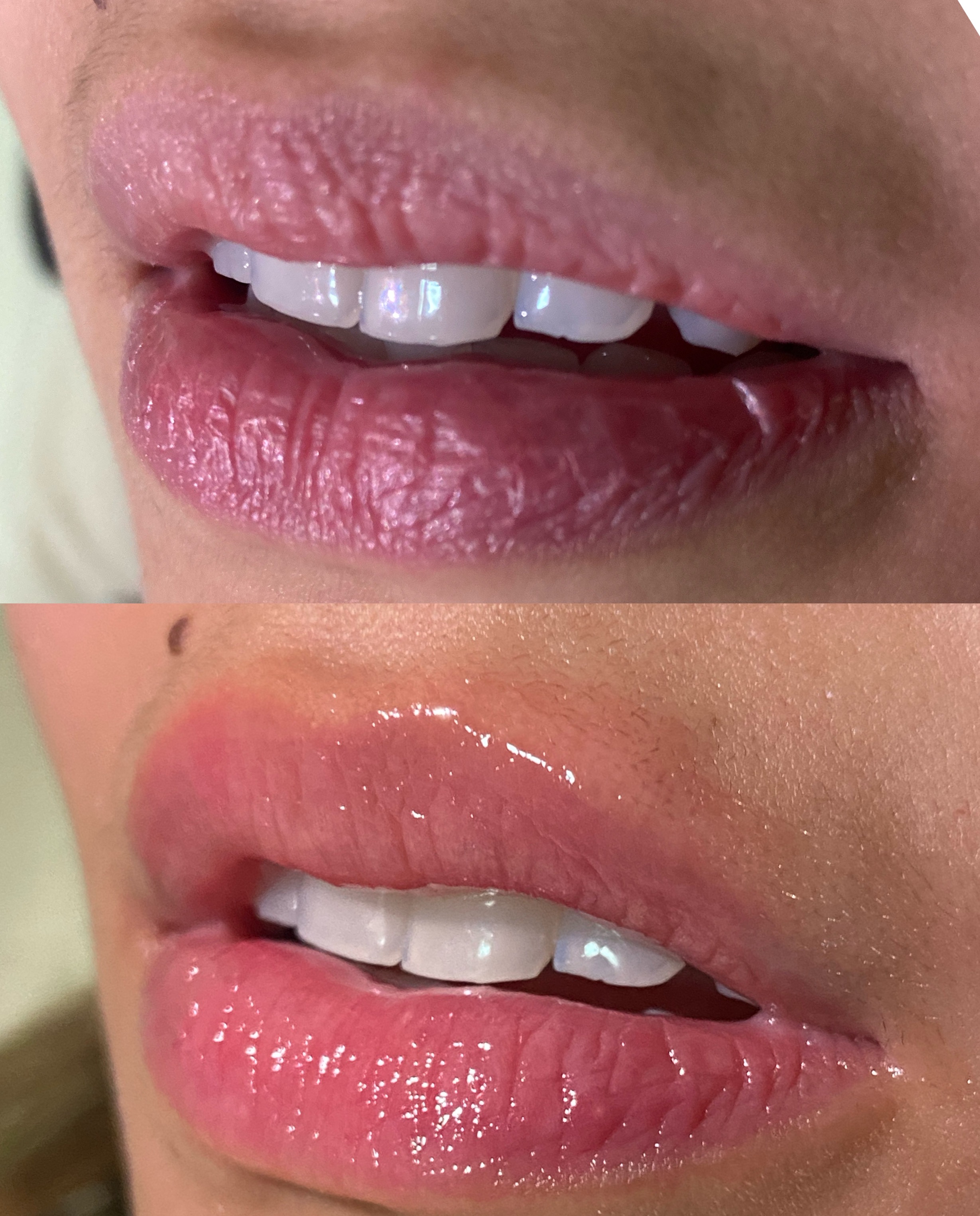 Hidragloss thumbnail