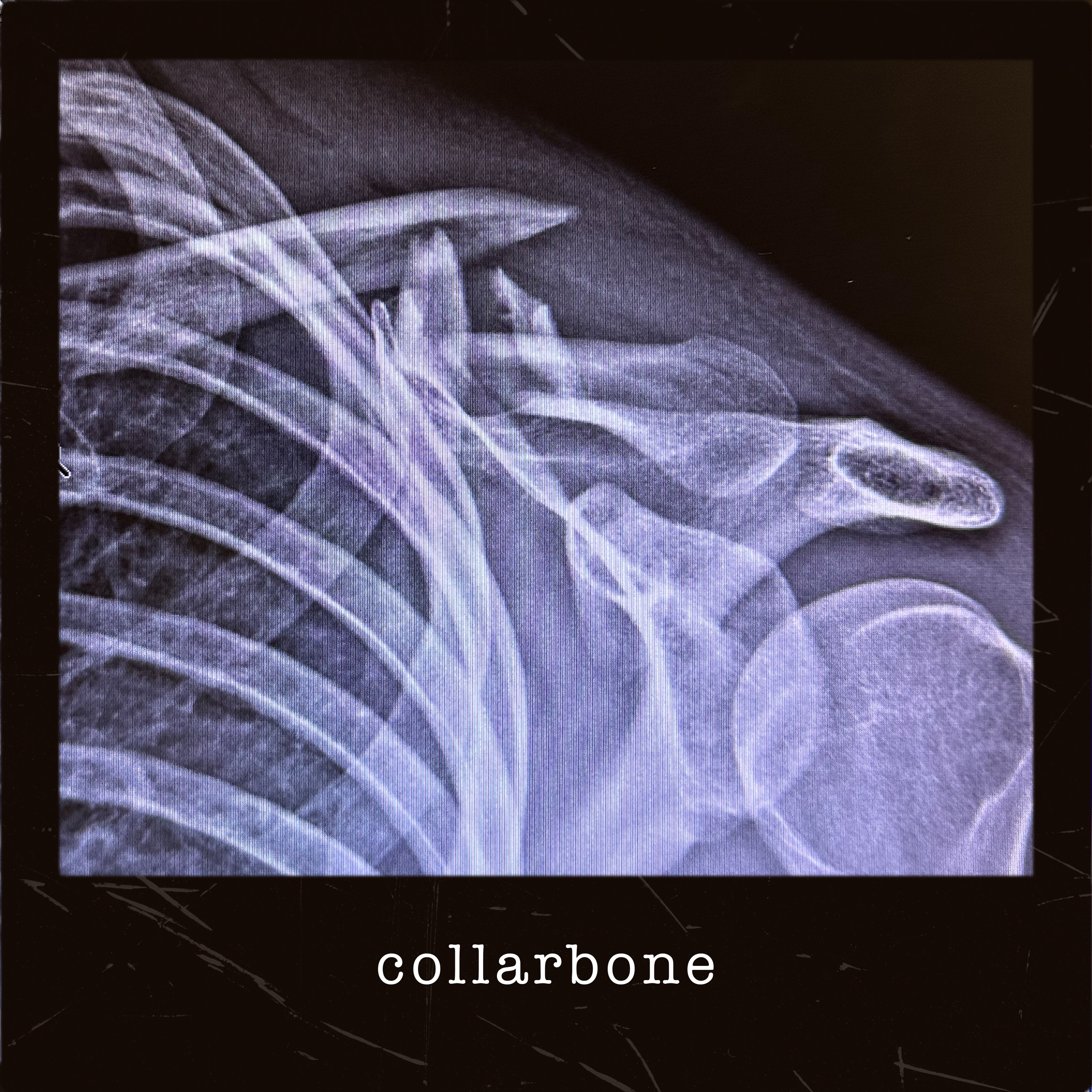 On Vacation "Collarbone" thumbnail