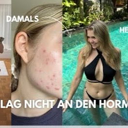Wie ich meine Darmprobleme, Akne & Dauerstress auf natürliche Weise gelöst habe thumbnail