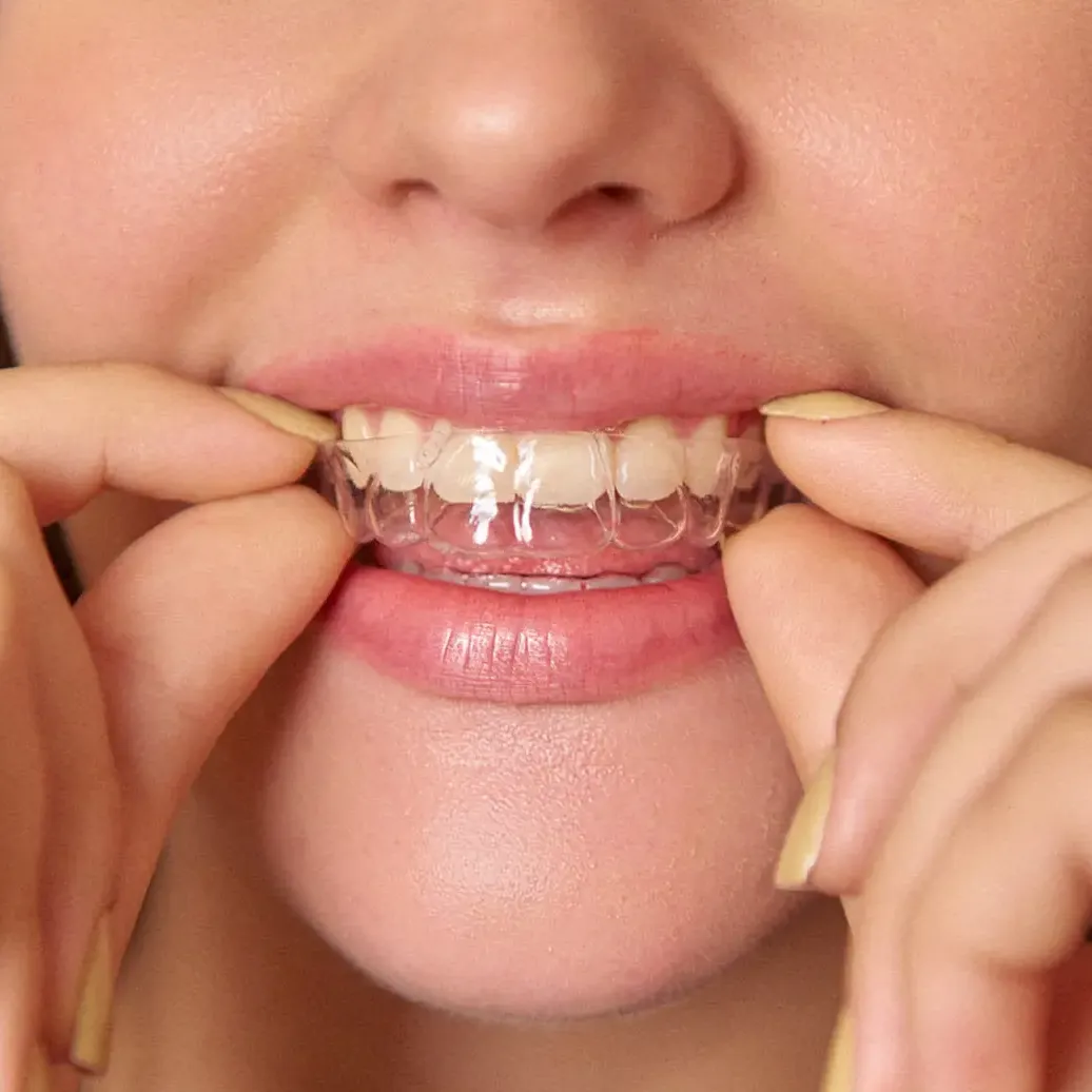 SouSmile | cupom RAQUEL thumbnail