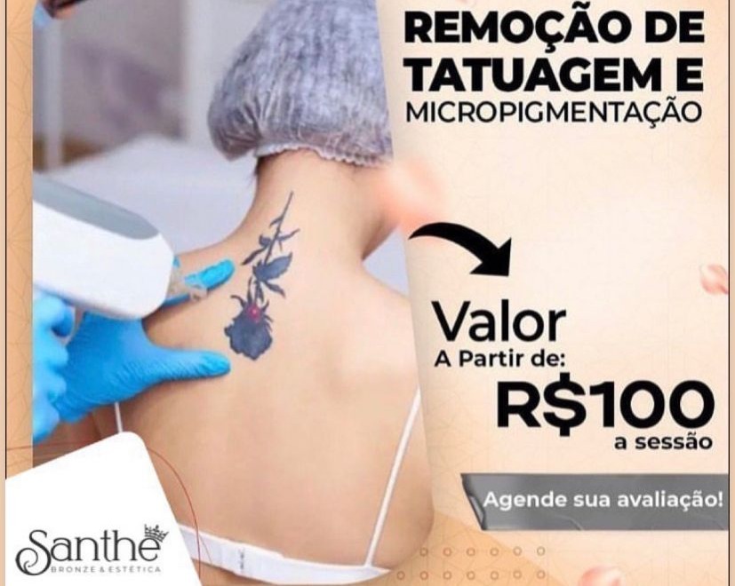Laser remoção de tatuagem e micropgmentação - Agende uma avaliação thumbnail