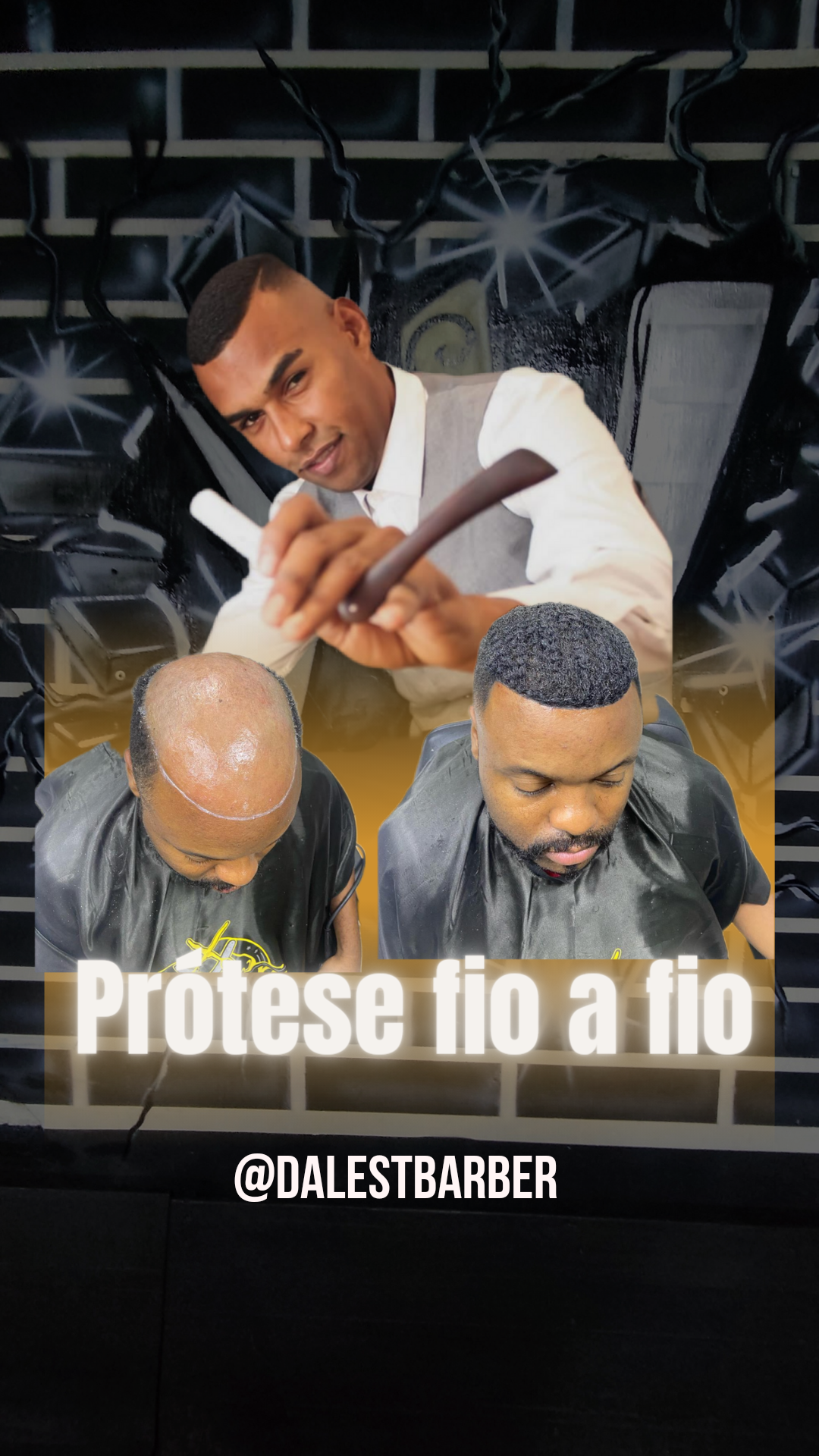 Prótese capilar fio a fio  thumbnail