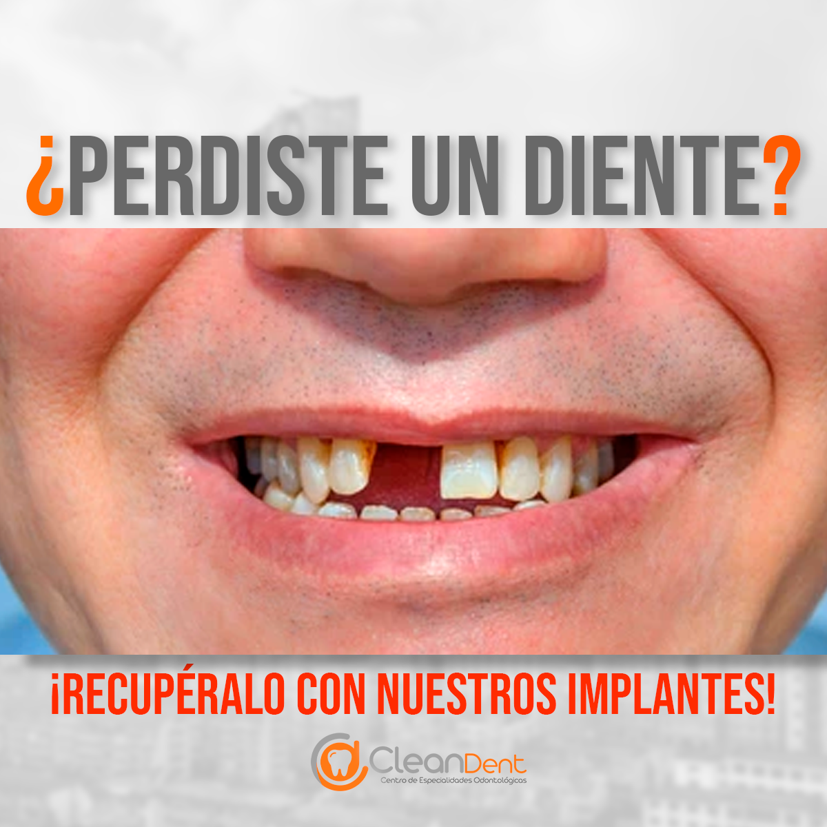 Endodoncia thumbnail